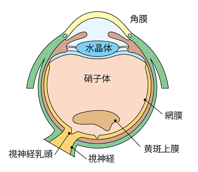 黄斑上膜とは