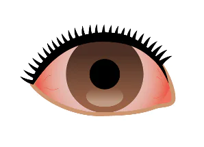 目が赤い・白目が真っ赤、片目だけの場合も？
